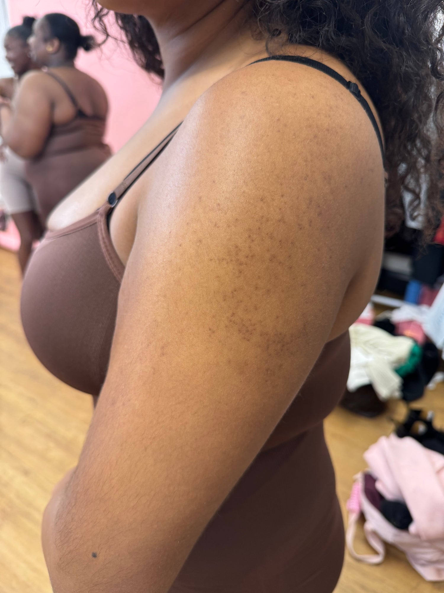 image comparison before