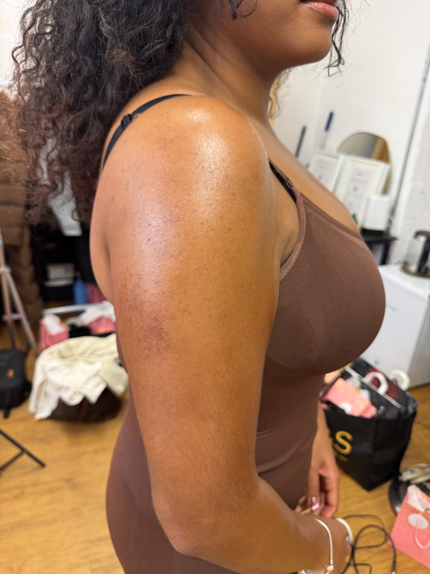 image comparison after